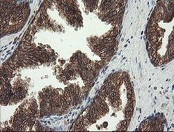 CXorf26 Monoclonal Antibody (OTI5A11), TrueMAB , OriGene 30 &mu;L; Unconjugated:Antibodies,