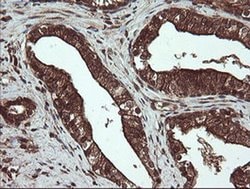 CXorf26 Monoclonal Antibody (OTI5A11), TrueMAB , OriGene 30 &mu;L; Unconjugated:Antibodies,