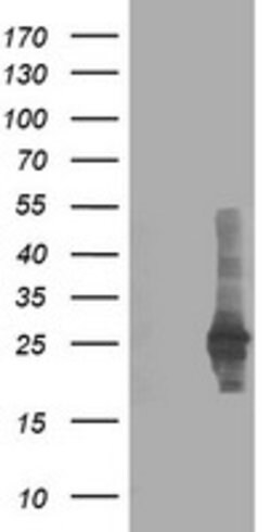 CXorf26 Mouse anti-Human, Clone: OTI1F3, lyophilized, TrueMAB 100 &mu;g;
