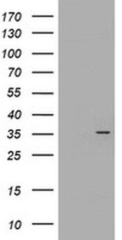 CYB5R1 Monoclonal Antibody (OTI2D10), TrueMAB , OriGene 100 &mu;L; Unconjugated:Antibodies,