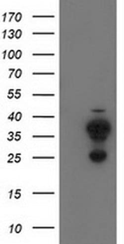 CYB5R2 Monoclonal Antibody (OTI4B9), TrueMAB , OriGene:Antibodies:Primary