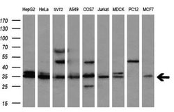 CYB5R2 Monoclonal Antibody (OTI4B9), TrueMAB , OriGene:Antibodies:Primary