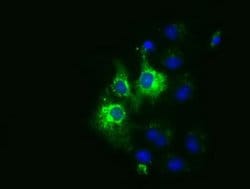 CYB5R3 Monoclonal Antibody (OTI1E3), TrueMAB , OriGene 30 &mu;L; Unconjugated:Antibodies,