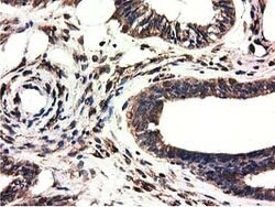 CYB5R3 Mouse anti-Canine, Human, Clone: OTI2A10, lyophilized, TrueMAB 100