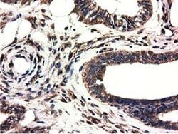 CYB5R3 Monoclonal Antibody (OTI2A10), TrueMAB , OriGene 100 &mu;L; Unconjugated:Antibodies,