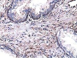 CYB5R3 Mouse anti-Canine, Human, Clone: OTI2A10, lyophilized, TrueMAB 100