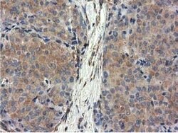 CYB5R3 Mouse anti-Canine, Human, Clone: OTI2A10, lyophilized, TrueMAB 100