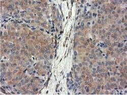 CYB5R3 Monoclonal Antibody (OTI2A10), TrueMAB , OriGene 100 &mu;L; Unconjugated:Antibodies,