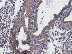 CYB5R3 Mouse anti-Canine, Human, Clone: OTI2A10, lyophilized, TrueMAB 100