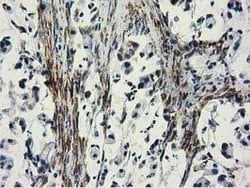 CYB5R3 Mouse anti-Canine, Human, Clone: OTI2A10, lyophilized, TrueMAB 100