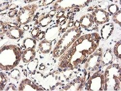CYB5R3 Mouse anti-Canine, Human, Clone: OTI2A10, lyophilized, TrueMAB 100
