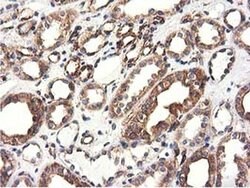 CYB5R3 Monoclonal Antibody (OTI2A10), TrueMAB , OriGene 100 &mu;L; Unconjugated:Antibodies,
