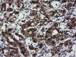CYB5R3 Mouse anti-Canine, Human, Clone: OTI2A10, lyophilized, TrueMAB 100