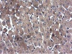 CYB5R3 Mouse anti-Canine, Human, Clone: OTI2A10, lyophilized, TrueMAB 100