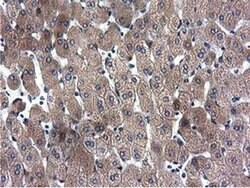 CYB5R3 Monoclonal Antibody (OTI2A10), TrueMAB , OriGene 100 &mu;L; Unconjugated:Antibodies,