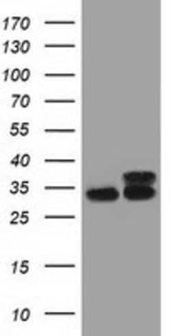 CYB5R3 Mouse anti-Canine, Human, Clone: OTI2A10, lyophilized, TrueMAB 100