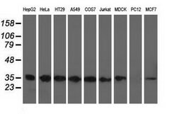 CYB5R3 Mouse anti-Canine, Human, Clone: OTI2A10, lyophilized, TrueMAB 100