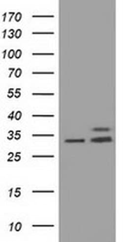 CYB5R3 Monoclonal Antibody (OTI1E3), TrueMAB , OriGene 30 &mu;L; Unconjugated:Antibodies,