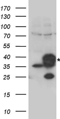 CYB5R3 Rabbit anti-Human, Polyclonal, liquid, OriGene 100 &mu;L; Unconjugated:Antibodies,