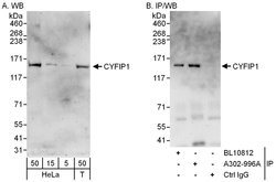 CYFIP1 Rabbit anti-Human, Polyclonal, Bethyl Laboratories 100 &mu;L; Unconjugated:Antibodies,