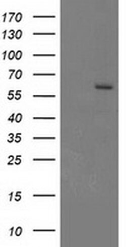 CYP17A1 Monoclonal Antibody (OTI9H4), TrueMAB , OriGene 30 &mu;L; Unconjugated:Antibodies,