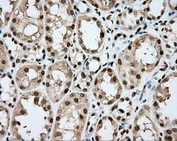CYP1A2 Mouse anti-Human, Clone: OTI6E2, lyophilized, TrueMAB 100 &mu;g;