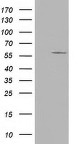 CYP1A2 Monoclonal Antibody (OTI7A9), TrueMAB , OriGene 100 &mu;L; Unconjugated:Antibodies,