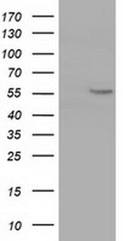CYP1A2 Monoclonal Antibody (OTI2E9), TrueMAB , OriGene 30 &mu;L; Unconjugated:Antibodies,