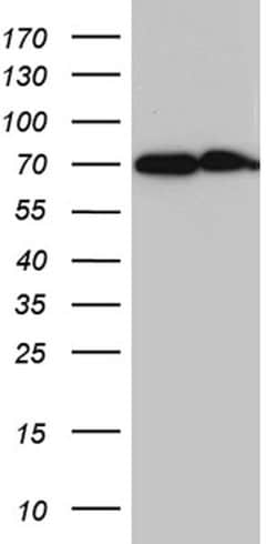 CYP26B1 Mouse anti-Human, Clone: OTI4A8, lyophilized, TrueMAB 100 &mu;g;