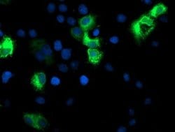 CYP2A6 Monoclonal Antibody (OTI5F8), TrueMAB , OriGene:Antibodies:Primary