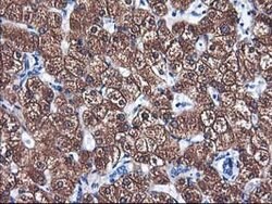 CYP2A6 Mouse anti-Human, Clone: OTI5F8, lyophilized, TrueMAB 100 &mu;g;