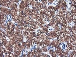 CYP2A6 Monoclonal Antibody (OTI5F8), TrueMAB , OriGene:Antibodies:Primary