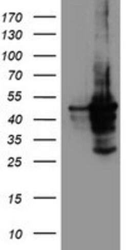 CYP2A6 Mouse anti-Human, Clone: OTI5F8, lyophilized, TrueMAB 100 &mu;g;