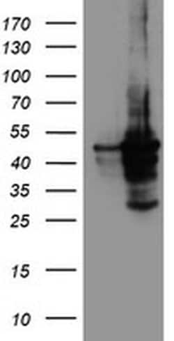CYP2A6 Monoclonal Antibody (OTI5F8), TrueMAB , OriGene 30 &mu;L; Unconjugated:Antibodies,