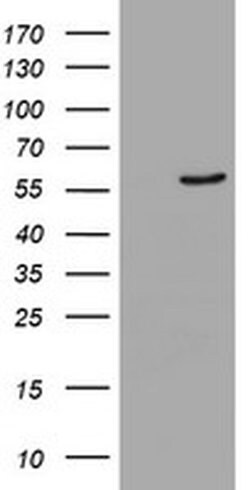 CYP2A6 Monoclonal Antibody (OTI9G3), TrueMAB , OriGene 30 &mu;L; Unconjugated:Antibodies,