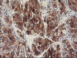 CYP2C9 Monoclonal Antibody (OTI3D2), TrueMAB , OriGene:Antibodies:Primary