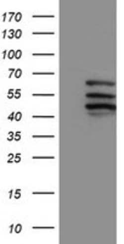 CYP2C9 Mouse anti-Human, Clone: OTI2C8, lyophilized, TrueMAB 100 &mu;g;