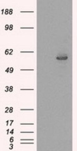 CYP2E1 Mouse anti-Human, Clone: OTI5F11, lyophilized, TrueMAB 100 &mu;g;
