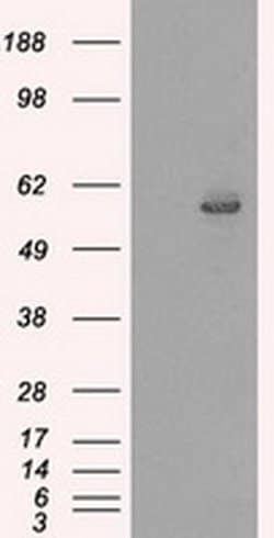 CYP2E1 Mouse anti-Human, Clone: OTI5F11, liquid, TrueMAB 100 &mu;L; Unconjugated:Antibodies,