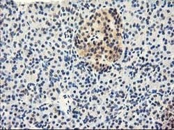 CYP2J2 Monoclonal Antibody (OTI3B4), TrueMAB , OriGene 100 &mu;L; Unconjugated:Antibodies,