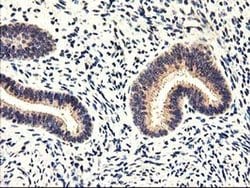 CYP2J2 Monoclonal Antibody (OTI3B4), TrueMAB , OriGene 100 &mu;L; Unconjugated:Antibodies,