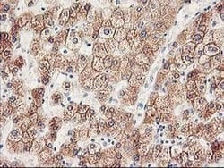 CYP2J2 Monoclonal Antibody (OTI3B4), TrueMAB , OriGene 100 &mu;L; Unconjugated:Antibodies,