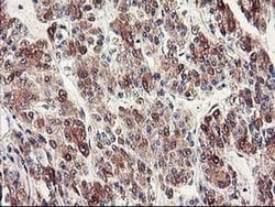 CYP2J2 Monoclonal Antibody (OTI3B4), TrueMAB , OriGene 100 &mu;L; Unconjugated:Antibodies,