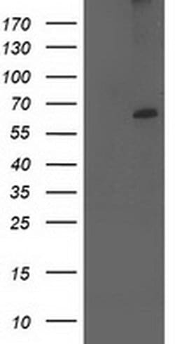 CYP2J2 Monoclonal Antibody (OTI2A9), TrueMAB , OriGene:Antibodies:Primary