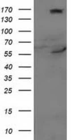 CYP2J2 Mouse anti-Human, Clone: OTI4B9, lyophilized, TrueMAB 100 &mu;g;
