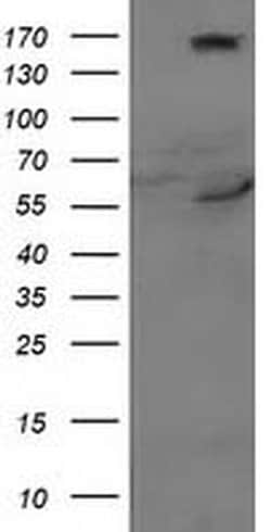 CYP2J2 Monoclonal Antibody (OTI4B9), TrueMAB , OriGene 100 &mu;L; Unconjugated:Antibodies,