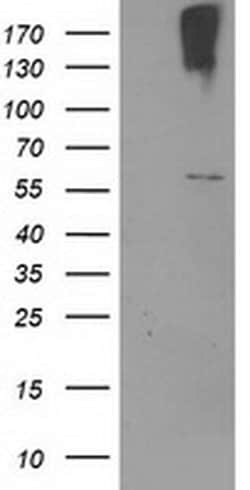 CYP2J2 Monoclonal Antibody (OTI3A7), TrueMAB , OriGene 100 &mu;L; Unconjugated:Antibodies,