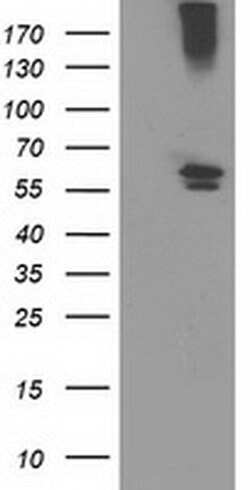 CYP2J2 Monoclonal Antibody (OTI3B4), TrueMAB , OriGene 100 &mu;L; Unconjugated:Antibodies,