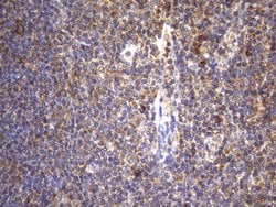CYTH2 Monoclonal Antibody (OTI4D9), TrueMAB , OriGene 100 &mu;L; Unconjugated:Antibodies,