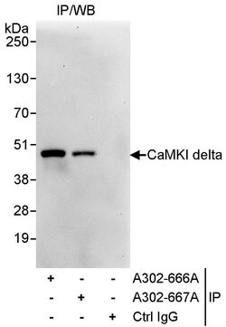 CaMKI delta Rabbit anti-Human, Polyclonal, Bethyl Laboratories 100 &mu;L;